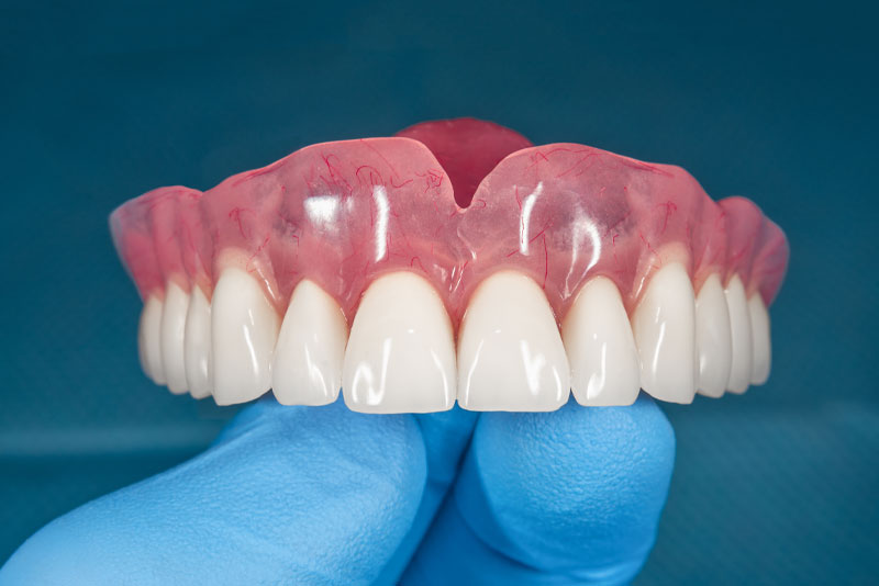 full denture