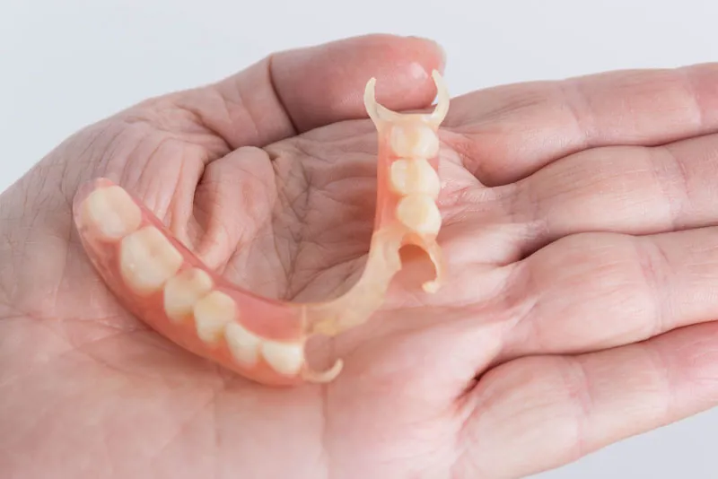 partial denture no metal