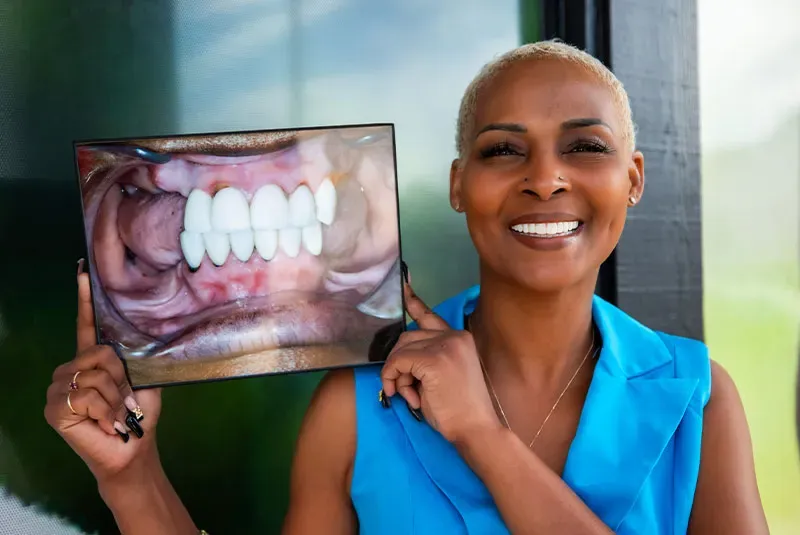 Happy patient displaying a new smile after same-day dental implants